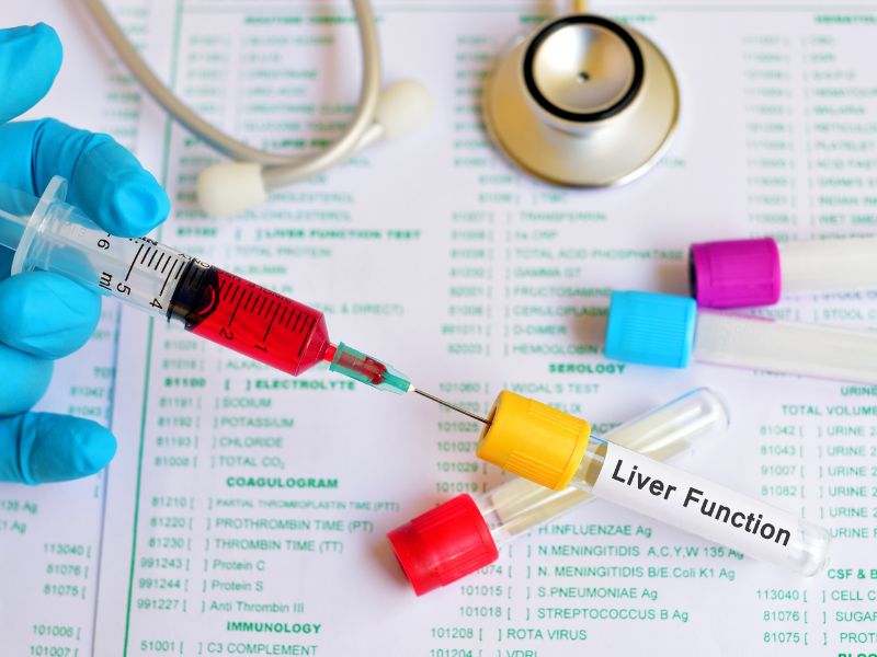 Check-up Funzionalità Epatica