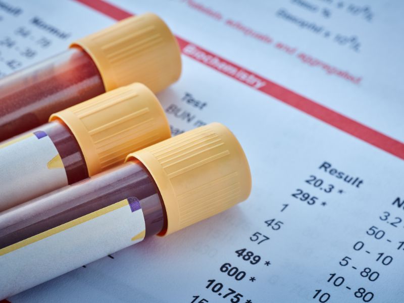 Check-up Vascolare e del Sangue base