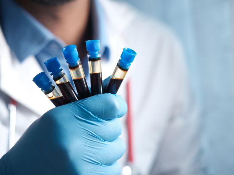 Check-up Cardiovascolare completo